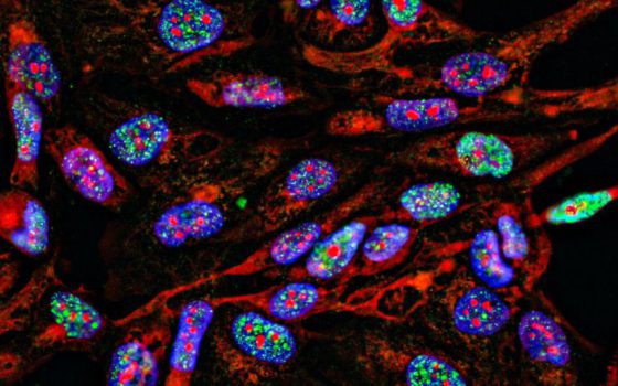 Immunofluorescence Staining Nasopharyngeal Carcinoma Cells